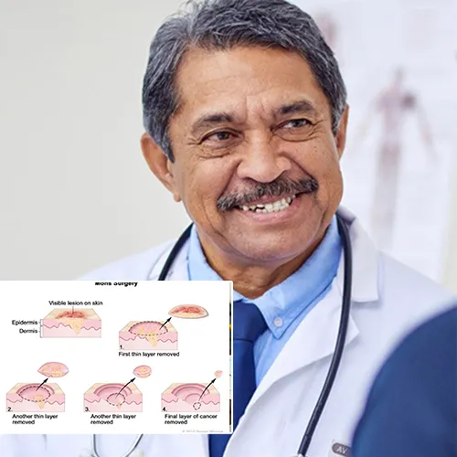 Unveiling the Technical Side: In-Depth Look at How Penile Implants Work