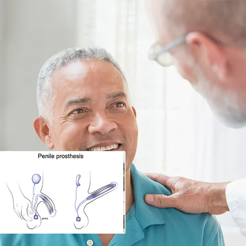 Connect with  Surgery Center of Fremont

for Your Penile Implant Surgery Needs